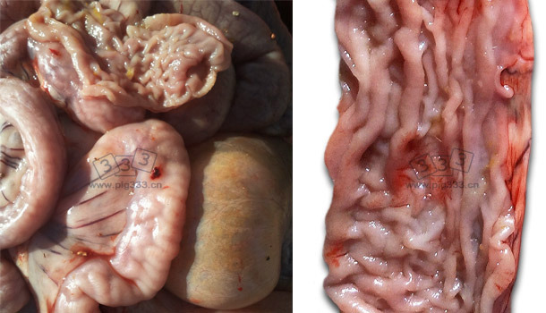 Thickening of the intestinal mucosa in the distal area of the small intestine