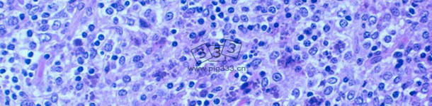 严重的淋巴细胞减少伴有淋巴组织肉芽图