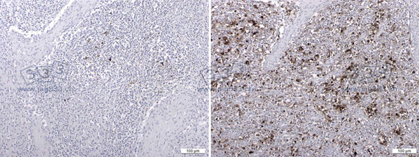 PCV2 antigen detected by an immunohistochemistry t 1