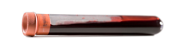 Measurement of time-to-virus-negative-piglets interval in PRRSv positive sow herds