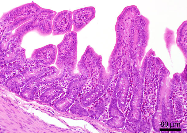 Histological section of the small intestine. In the mucosa several eosinophilic granulocytes are located.