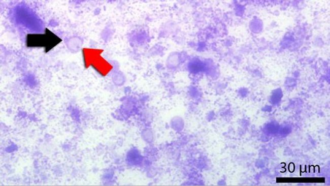 Fecal smear stained with Diff-Quick. Red arrow indicates the central vacuole. Black arrow indicates the nucleus