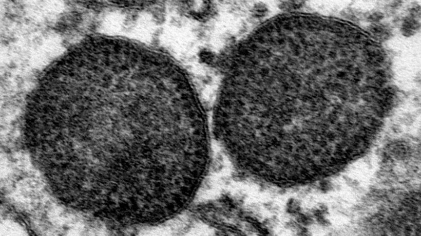 Electron micrograph of two inclusion bodies in the cytoplasm of a macrophage, including a very high number of PCV2 particles. 150.000x. Source: Carolina Rodr&iacute;guez-Cari&ntilde;o, CReSA
