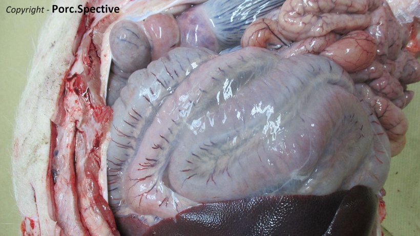 Photo 2. Edema of the mesentery of spiral colon