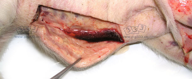 皮下组织肿胀，切开下肢皮肤后，有大量液体流出。