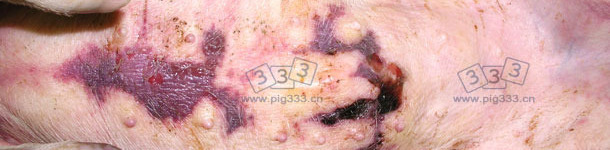 胸骨部位皮下有积水