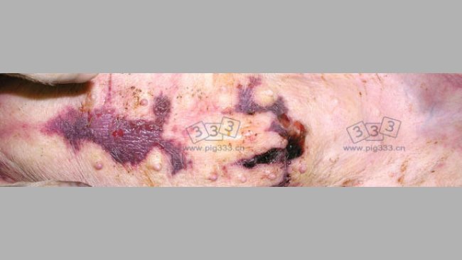 胸骨部位皮下有积水