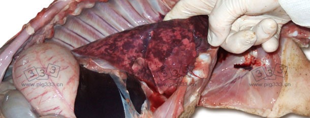 间质性肺炎多表现出的肺部增大,斑片状肺,肺部呈橡胶状