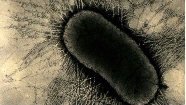 E coli fimbrial or pilus proteins, which firmly attach to enterocyte glycoprotein receptors on the intestinal cells