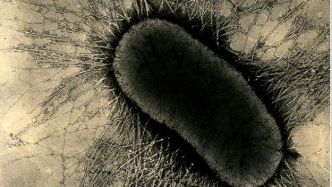 E coli fimbrial or pilus proteins, which firmly attach to enterocyte glycoprotein receptors on the intestinal cells