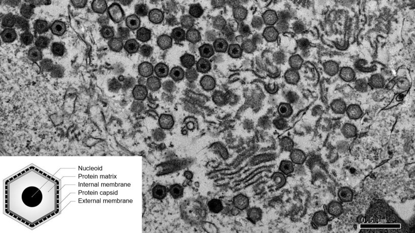 electron microscopy image of a cell infected by the asf virus.