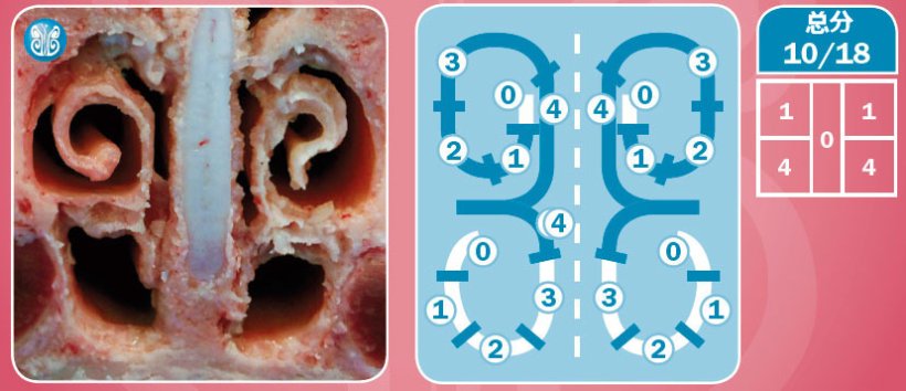 图6.以受重度AR影响的动物为例,对鼻部病变的评估。
