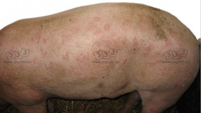 Urticarial form of swine erysipelas
