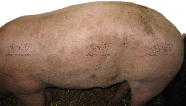 Urticarial form of swine erysipelas