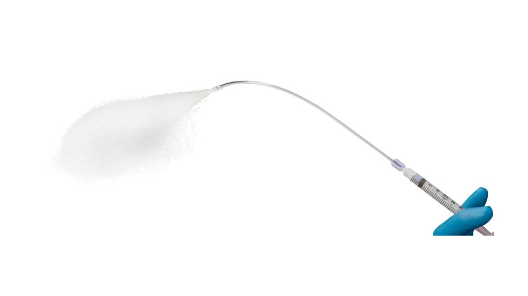  图1：粘膜雾化装置