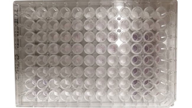 用96孔板酶联免疫斑点法测定蓝耳病病毒特异性γ-干扰素(IFN-γ)分泌细胞的实例。