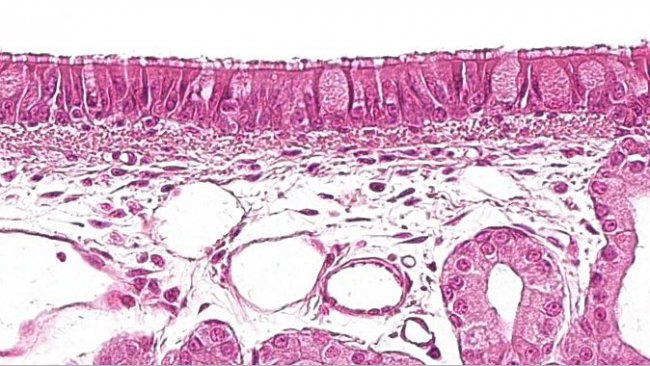 图1：具有杯状细胞的纤毛假复层上皮，是呼吸系统的特征。