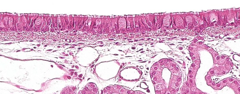 图1:具有杯状细胞的纤毛假复层上皮,是呼吸系统的特征.