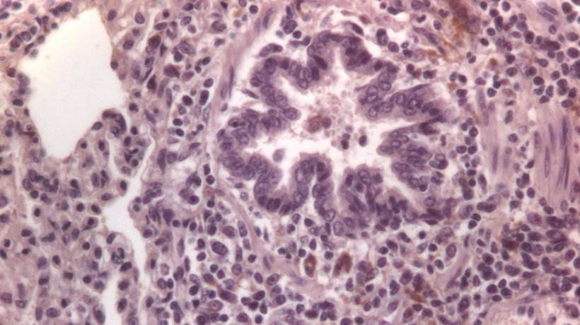 图3：肺中PCV2免疫标记细胞。