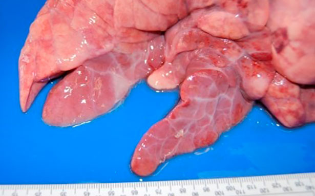 图1：猪肺炎支原体引起的支气管间质性肺炎