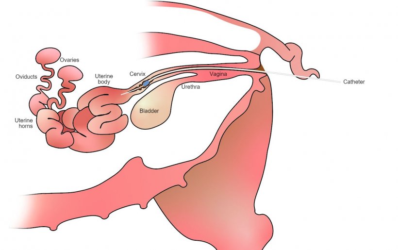 图1：进行宫颈后授精后，精液通过子宫颈沉积在子宫体内。