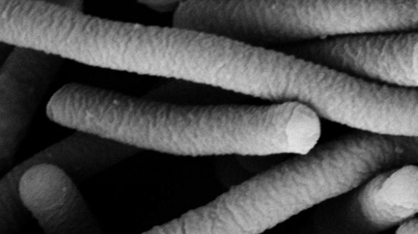 图1：嗜酸乳杆菌的电子显微照片，具有益生菌特性。照片由Mogana Das Murtey 和 Patchamuthu Ramasamy提供