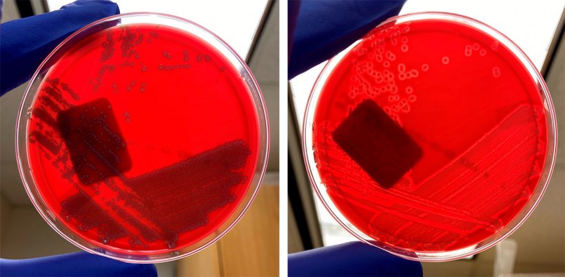 非溶血性大肠杆菌（左）和溶血性大肠杆菌（右）。