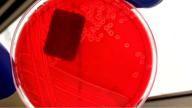 •	图1：在血琼脂平板上的溶血性大肠杆菌纯培养。注意每个菌落周围的清晰区域，表明溶血（平板琼脂中的血液分解）。图片来源：爱荷华州立大学，兽医诊断实验室，细菌学科