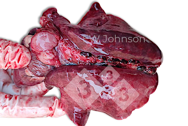 图2：橡胶肺伴出血性肺淋巴结肿大

